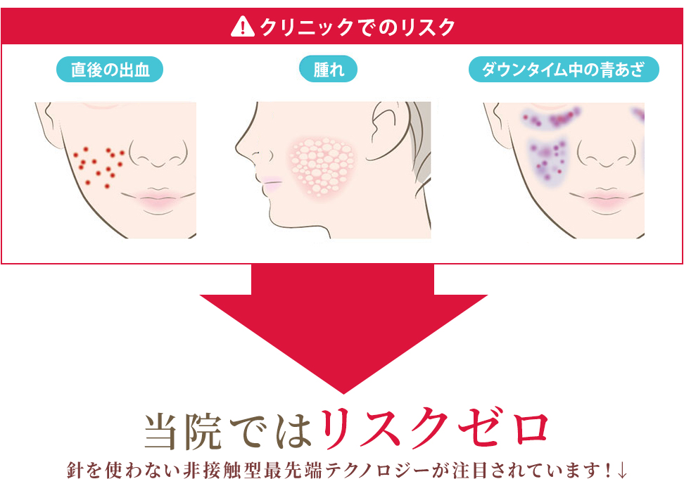 当店ではリスクゼロ