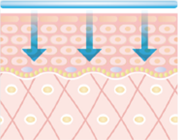 STEP2